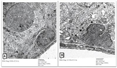 An electron microscopic and biochemical study of the potential protective effect of ginger against Cadmium-induced testicular pathology in rats